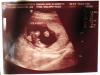 Week 16: It's a Boy!